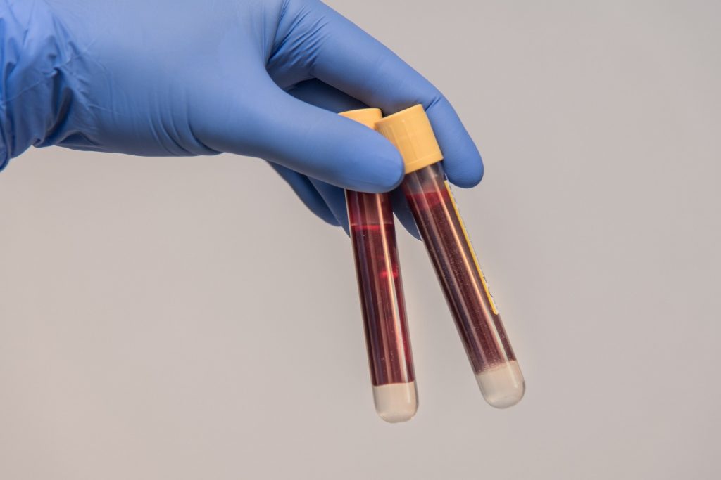 blood sample 6200016 1920