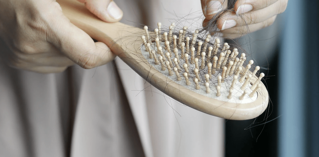 Dieses Verfahren könnte Haartransplantationen ersetzen