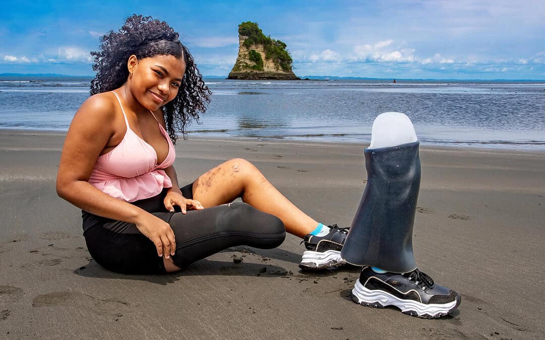 Maribel aus Kolumbien verlor durch eine Landmine ihr Bein, aber nicht ihre Stärke
