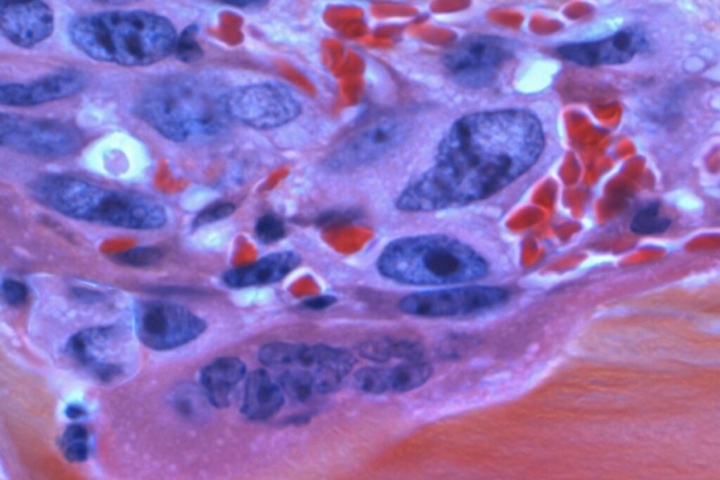 Krebs zellen National Cancer Institut