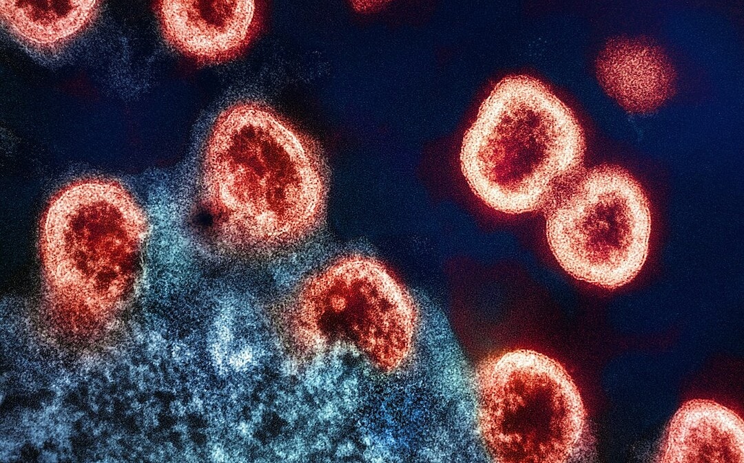 Hoffnung auf Heilung von AIDS, Urnen aus Pilzen