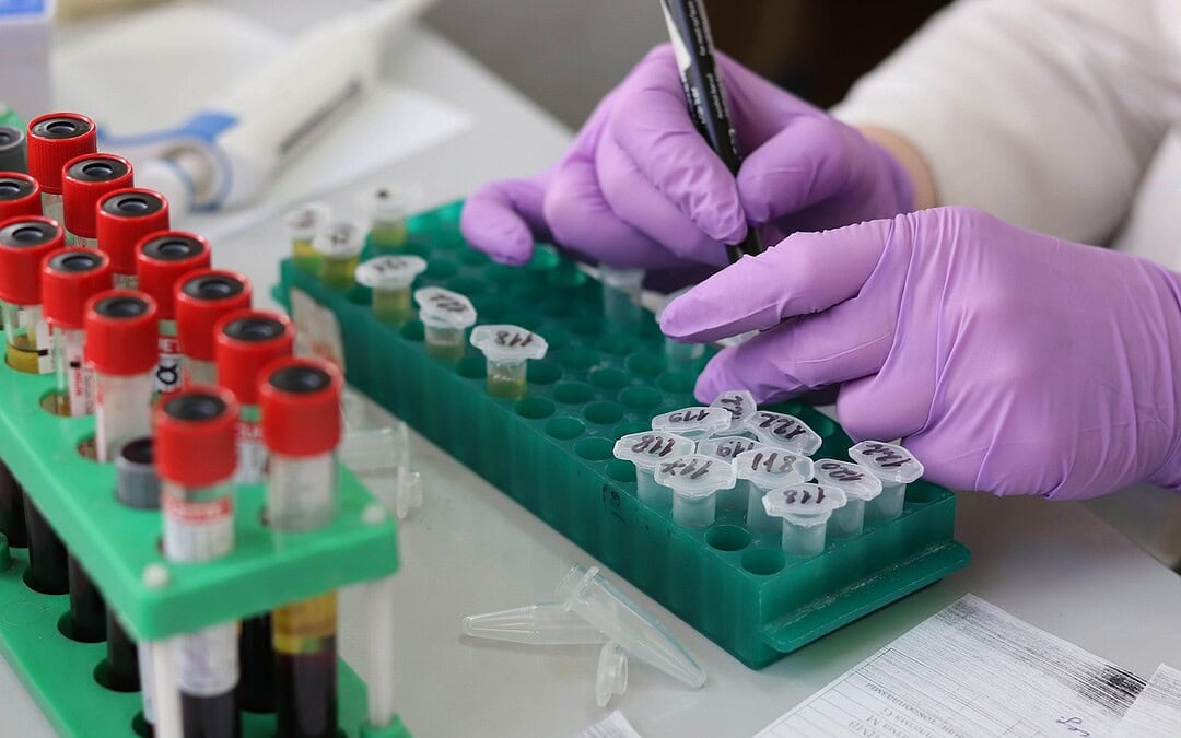 Ebola-Ausbruch im Kongo ist beendet: Wie schnelle Impfungen Leben schützen