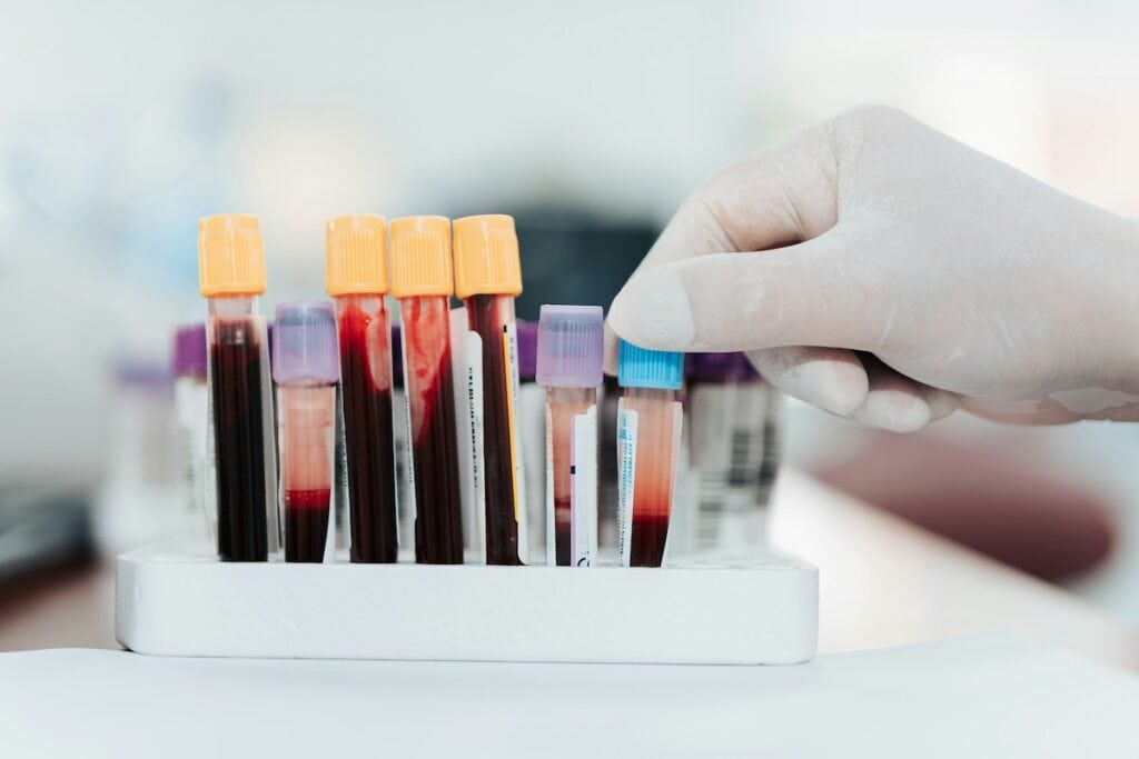 Blut Labor